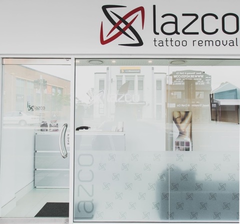 The Laser Tattoo Removal Process | Lazco Tattoo Removal